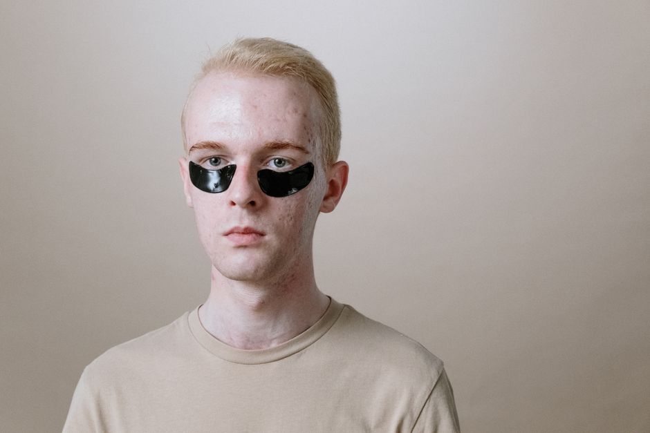 Portrait of a young man wearing under-eye patches, focusing on skincare and self-care routine.